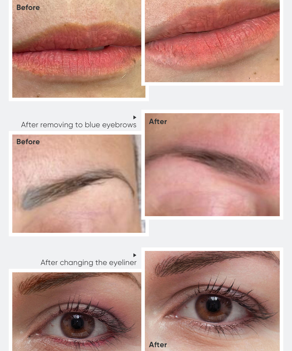 BIOMASER Pigment Removal Solution