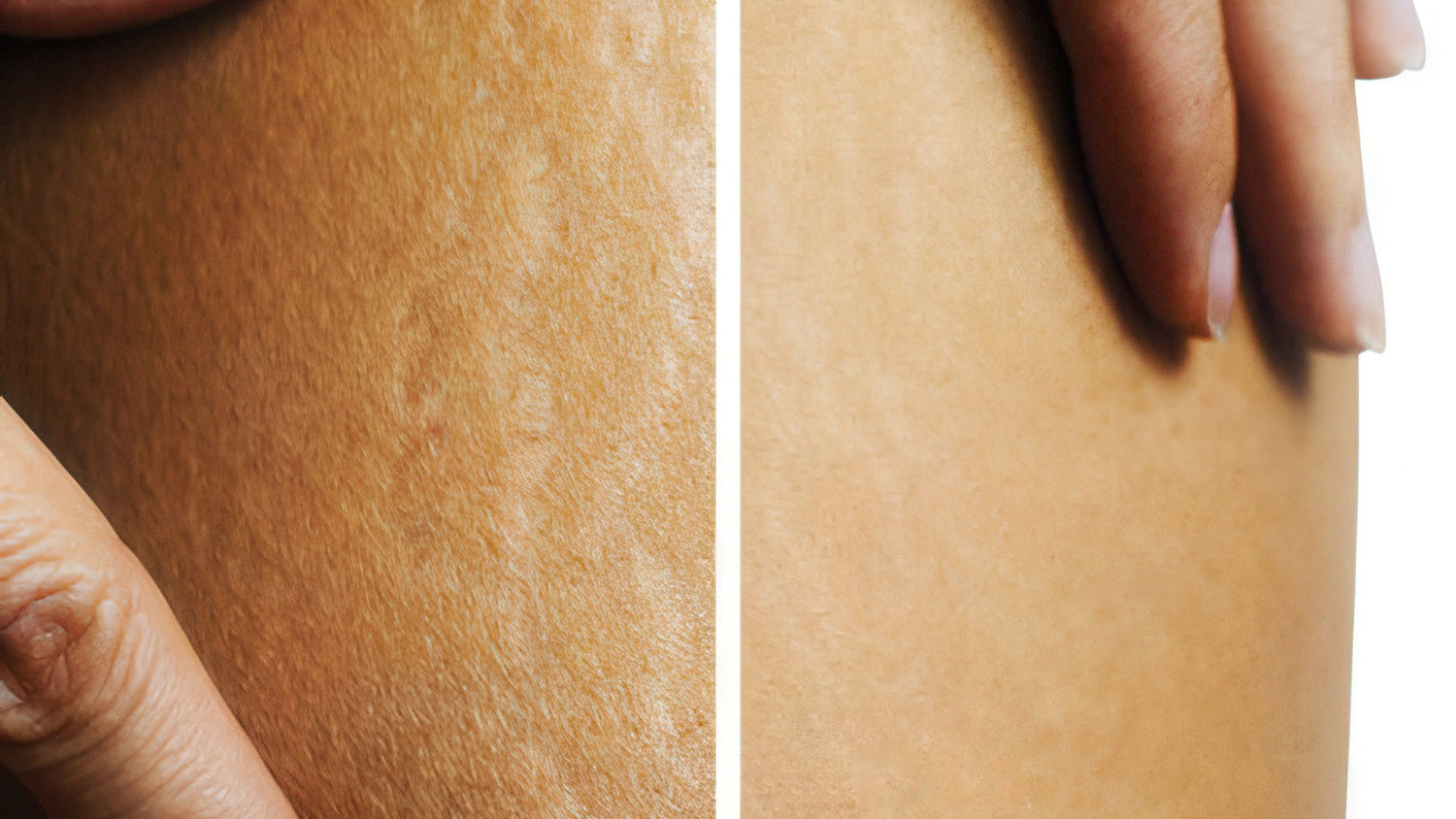 How PMU Scar Camouflage Conceals Scars and Skin Imperfections