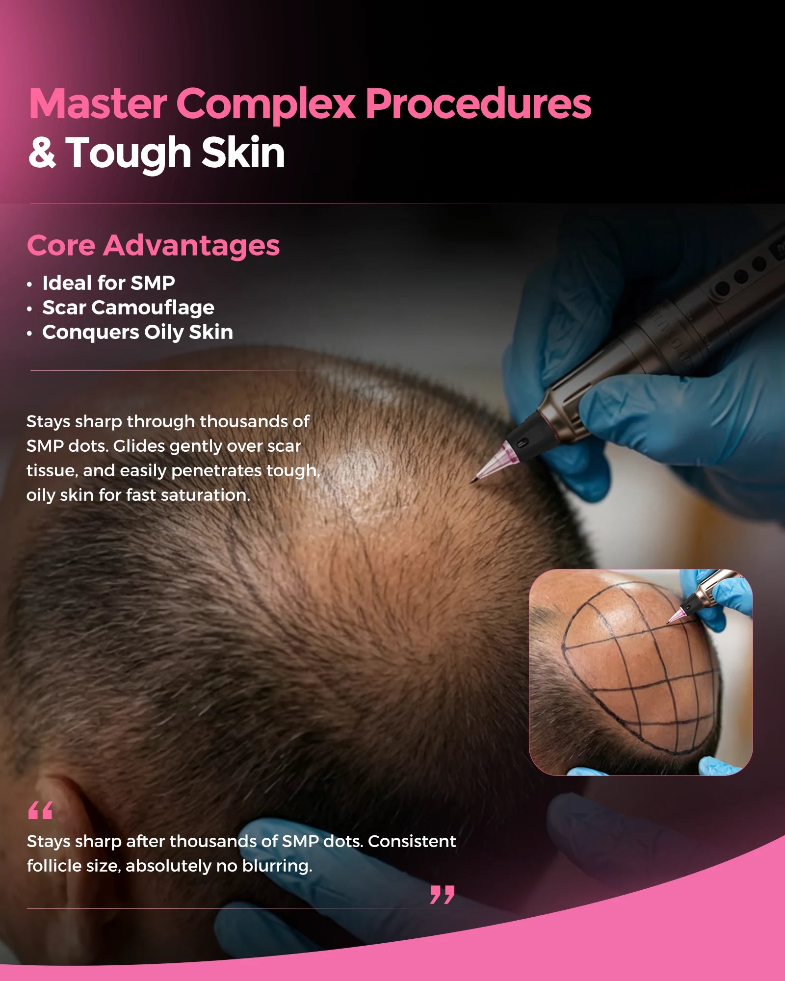 Biomaser Pinky Ultra Cartridge Needles